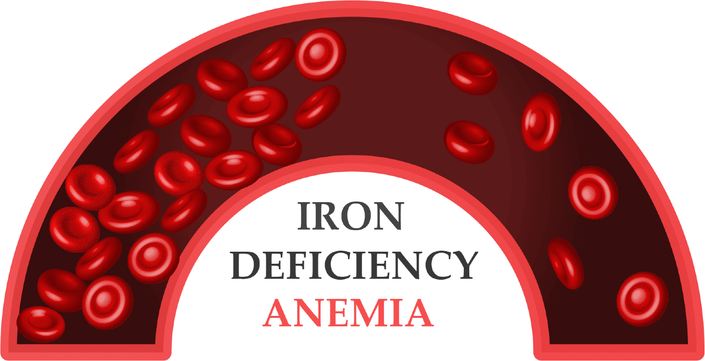 Using Soluble Transferrin Receptor (sTfR) and the sTfR/log ferritin index for the diagnosis of