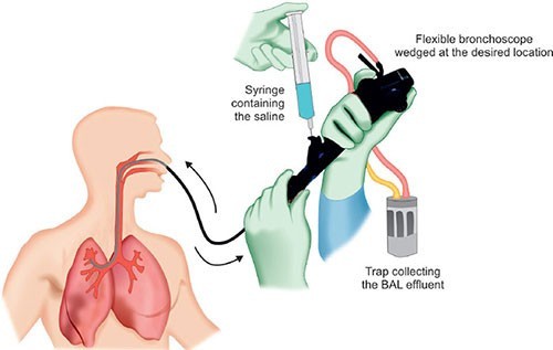 UNDERSTANDING THE FLU PANEL TESTING